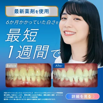 ホワイトニング施術「ホワイトエッセンスコースエクスプレス」