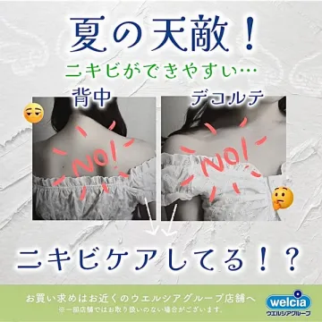 夏のニキビ対策：背中・デコルテ用ケア