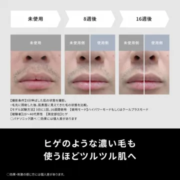 男性用家庭用脱毛器ヒゲ使用ビフォーアフター検証