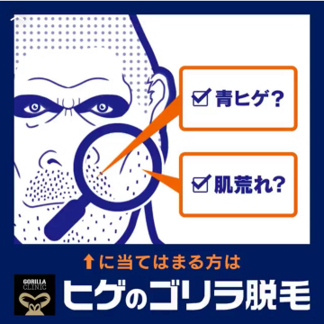 青ヒゲ・肌荒れ悩みに特化！ゴリラクリニックのヒゲ脱毛