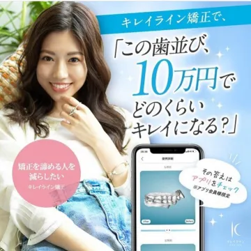 キレイライン矯正の歯並び診断アプリと矯正サービス