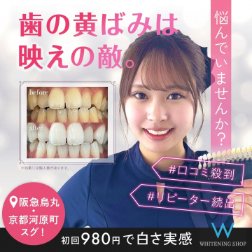 WHITENING SHOP 歯の黄ばみ解消ホワイトニング初回体験