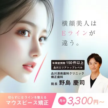 Eラインを整えるマウスピース矯正サービス