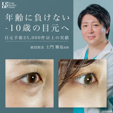 Leap beauty clinicの年齢に負けない-10歳目元治療