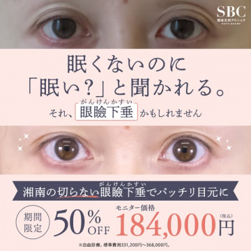 湘南美容クリニックの切らない眼瞼下垂治療でパッチリ目元に