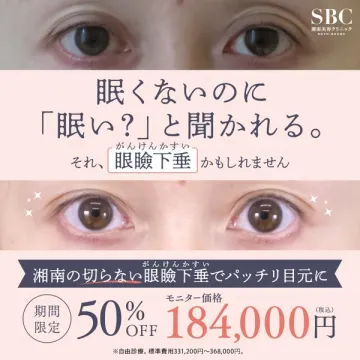 湘南美容クリニックの切らない眼瞼下垂治療でパッチリ目元に