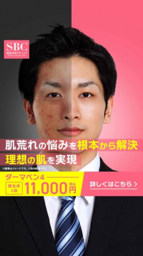 湘南美容クリニックのダーマペン4による肌質改善治療