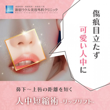 人中短縮術（リップリフト）で鼻下を短くする美容施術